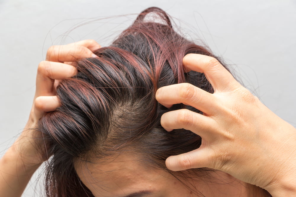 Home Remedies For Dry Scalp