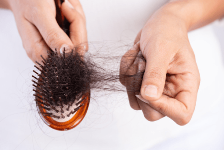 common eating habits that cause excessive hair loss