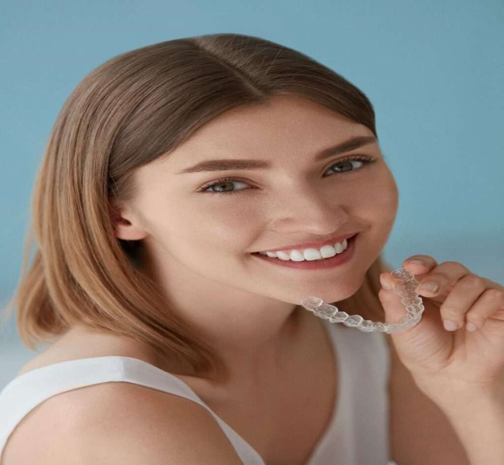 Features of Clear Aligners