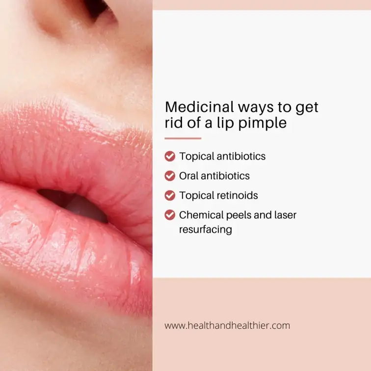 Medicinal ways to get rid of a lip pimple